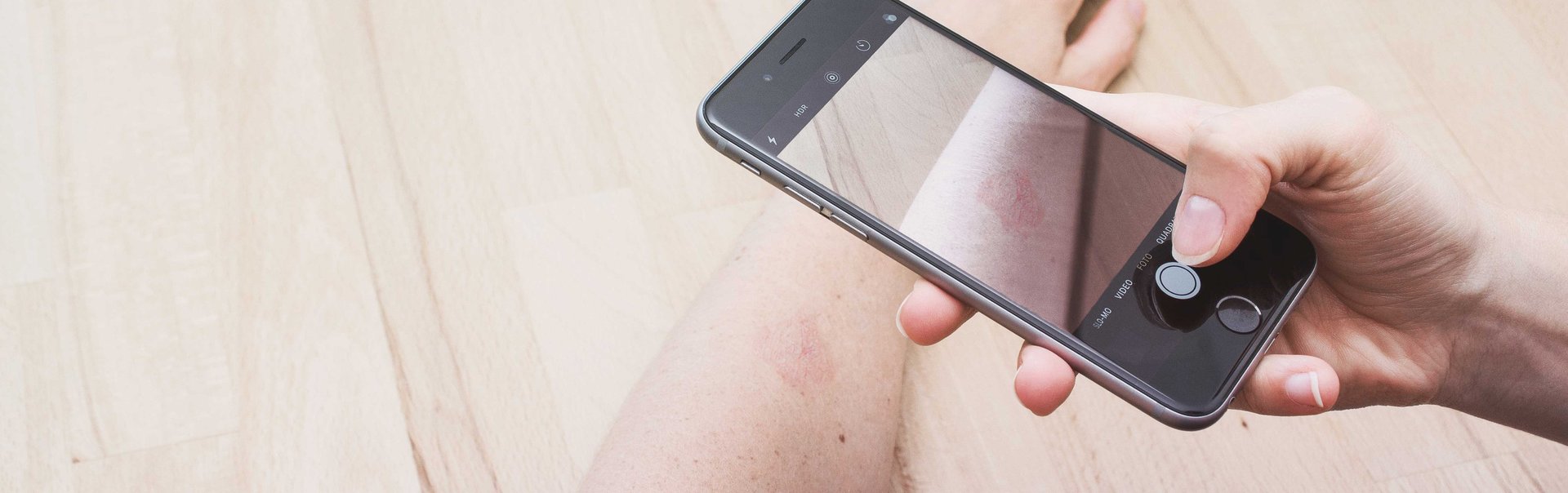 Eine Person scannt ein Muttermal auf dem Arm mit dem Smartphone ab.