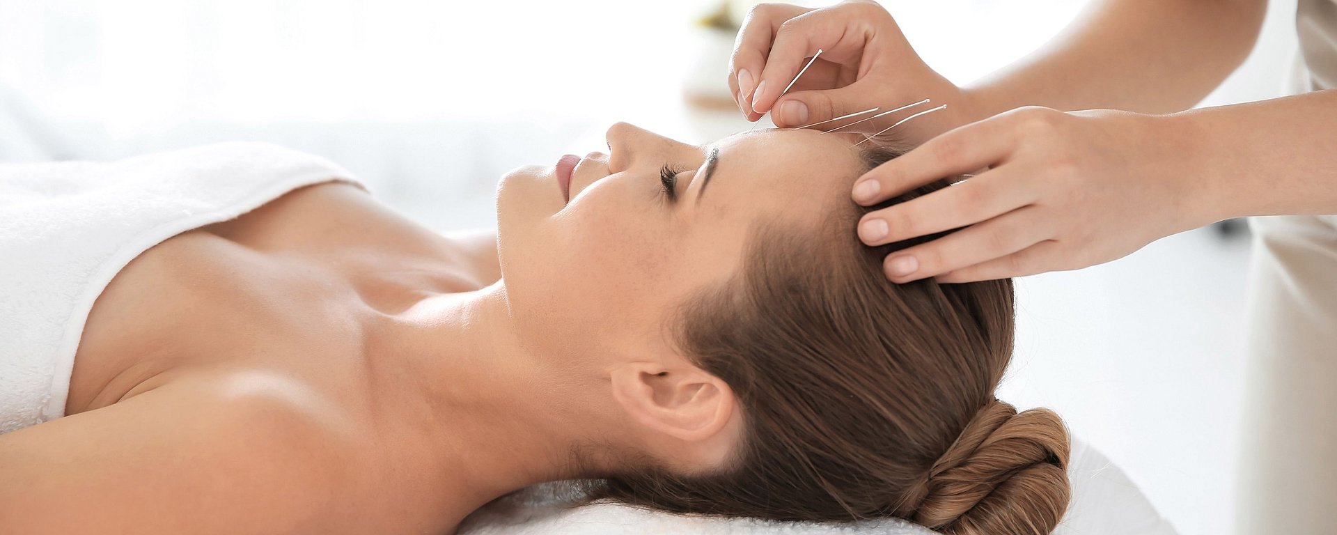 Eine Frau, die auf einer Wellnessliege liegend eine Akupunkturbehandlung an der Stirn erhält, die Augen geschlossen und entspannt.